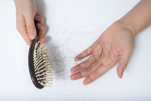 10 Tips for Managing Hair Loss with a Chronic Illness